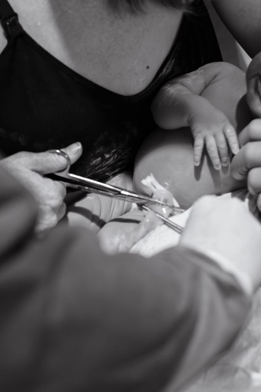 The baby laid on her chest, the cord about to be cut